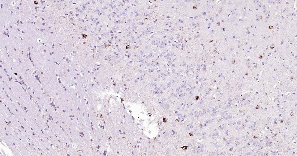 生长抑素重组兔单抗