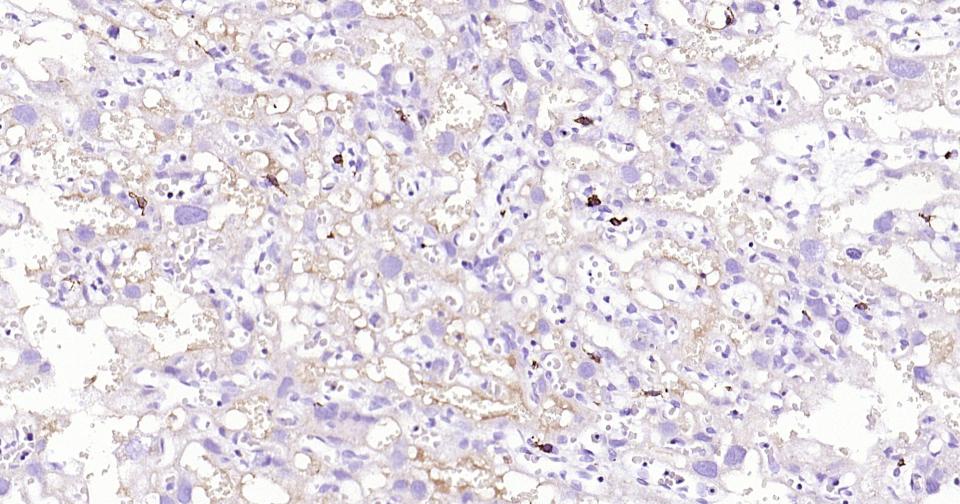 CD163重组兔单抗