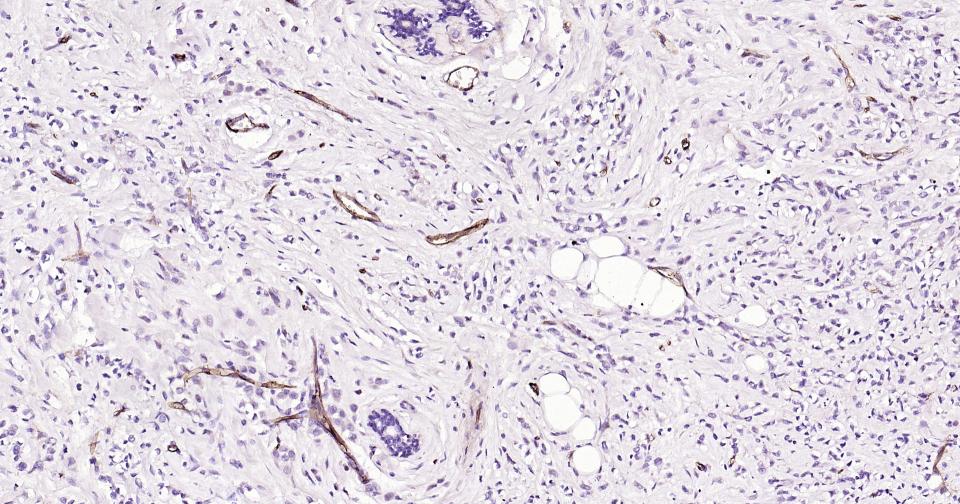 CD105抗体-bsm-41201M