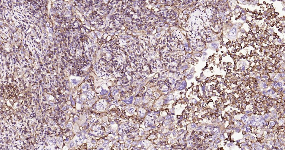 小鼠抗人CD44单克隆抗体-bsm-30038M