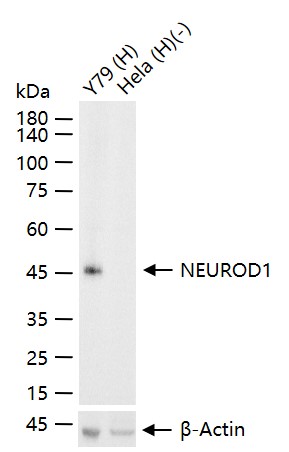 NEUROD1 Recombinant Rabbit mAb (一抗) | Bioss
