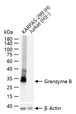 颗粒酶B重组兔单克隆抗体