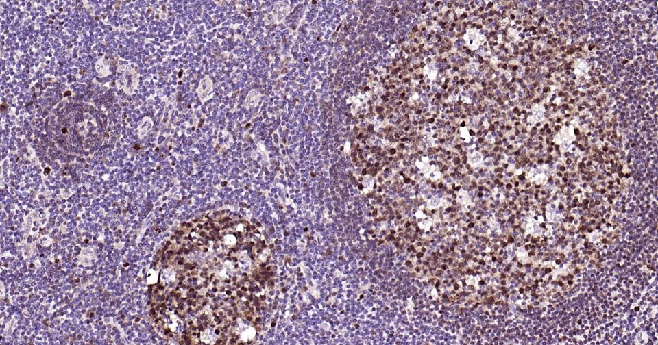 磷酸化核因子2相关因子2(Ser40)重组兔单抗