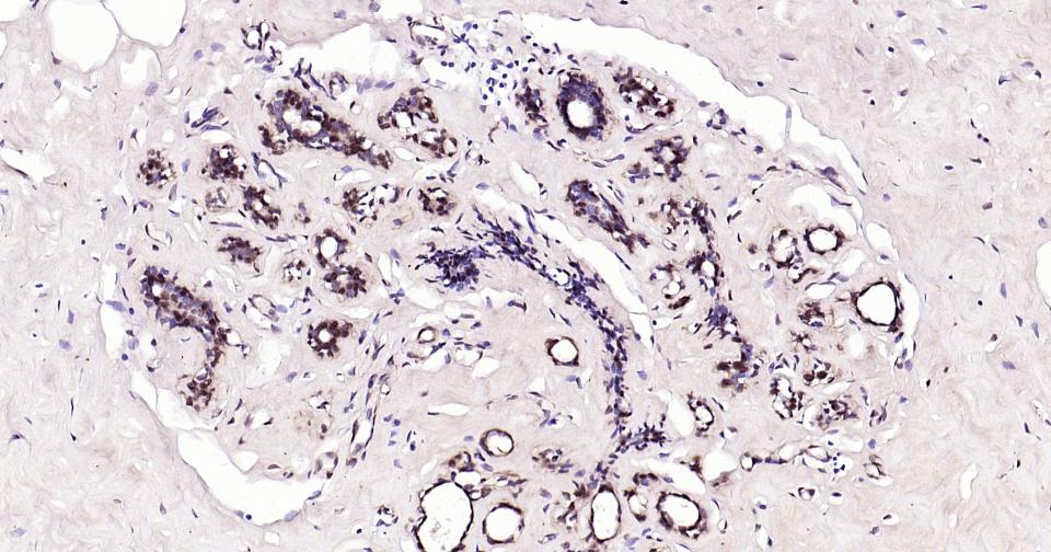 泛素蛋白(K48-linkage)重组兔单抗