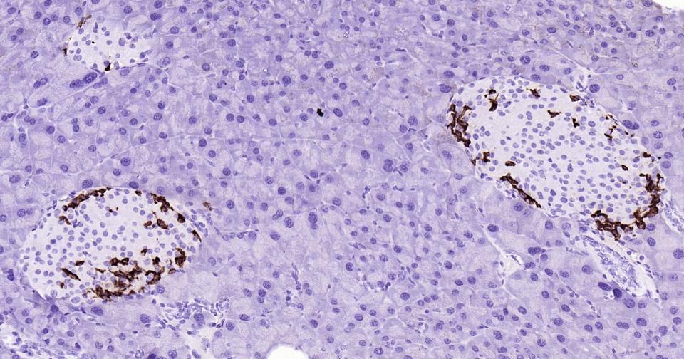 生长抑素重组兔单抗