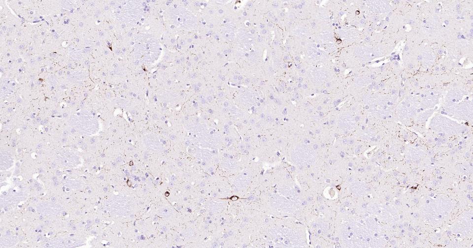 生长抑素重组兔单抗