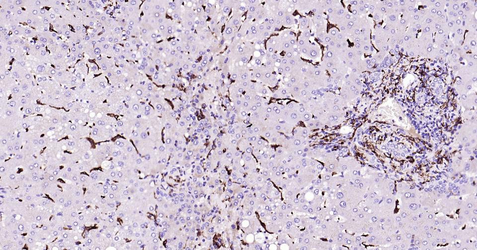 CD163重组兔单抗