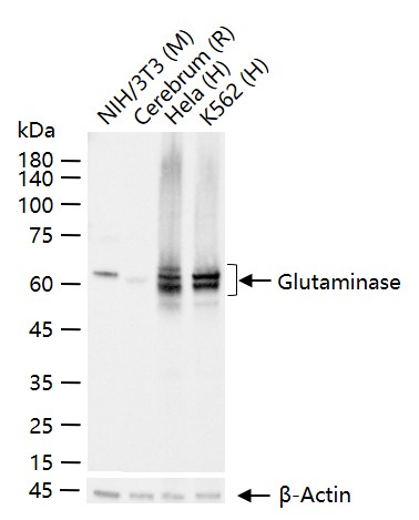 谷氨酰胺酶重组兔单抗