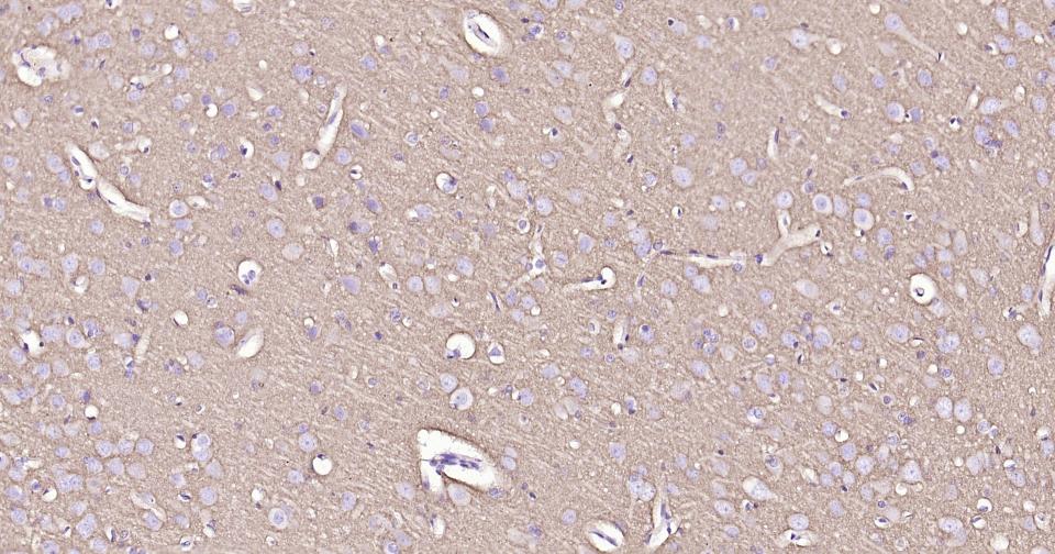 神经生长相关蛋白43重组兔单克隆抗体