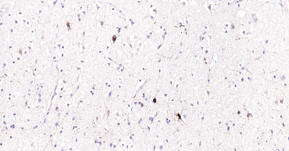 生长抑素重组兔单抗