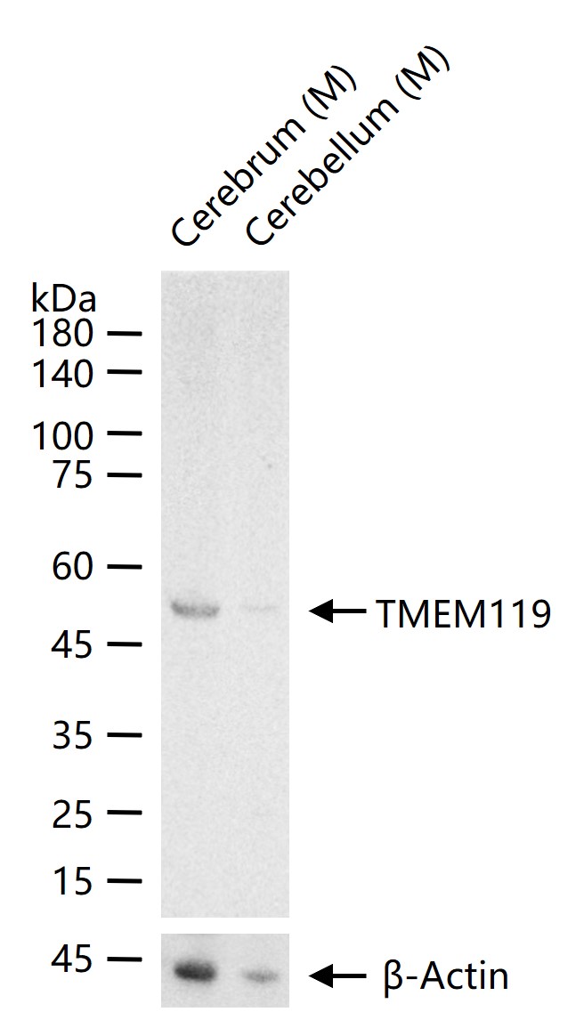 TMEM119 Mouse mAb (一抗) | Bioss
