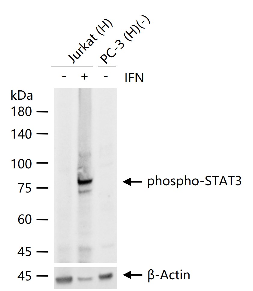 磷酸化信号转导和转录激活因子3重组兔单抗