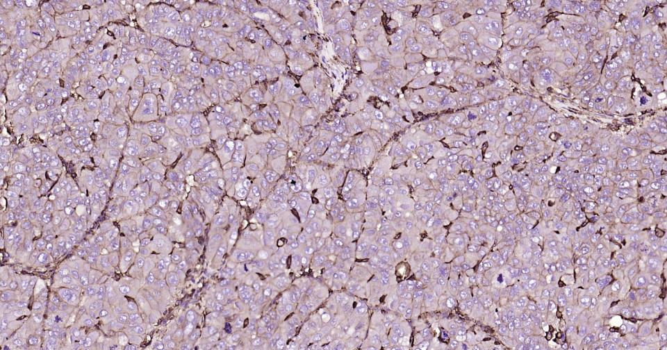 葡萄糖转运蛋白1重组兔单抗