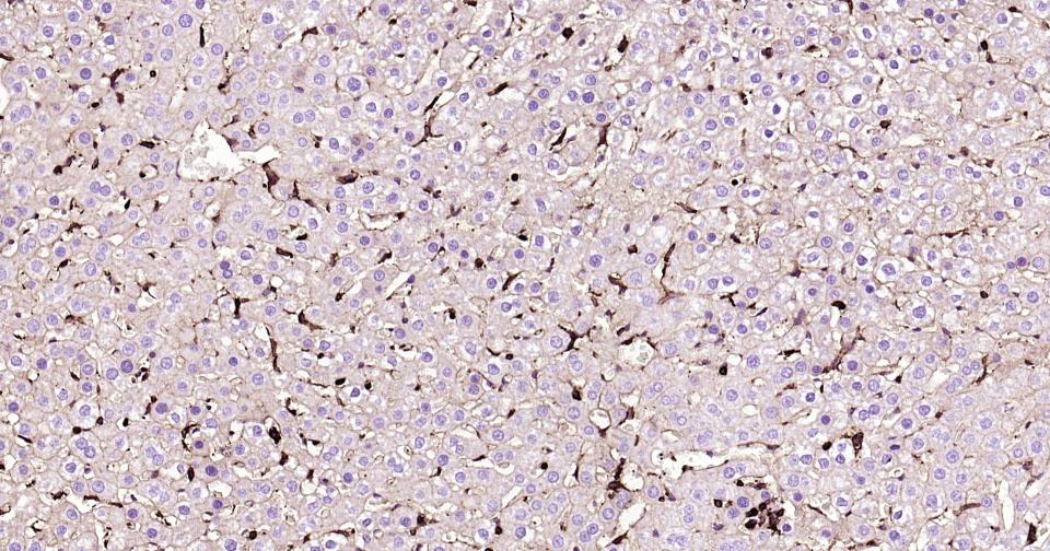 葡萄糖转运蛋白1重组兔单抗