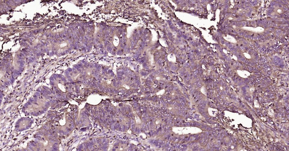 葡萄糖转运蛋白1重组兔单抗