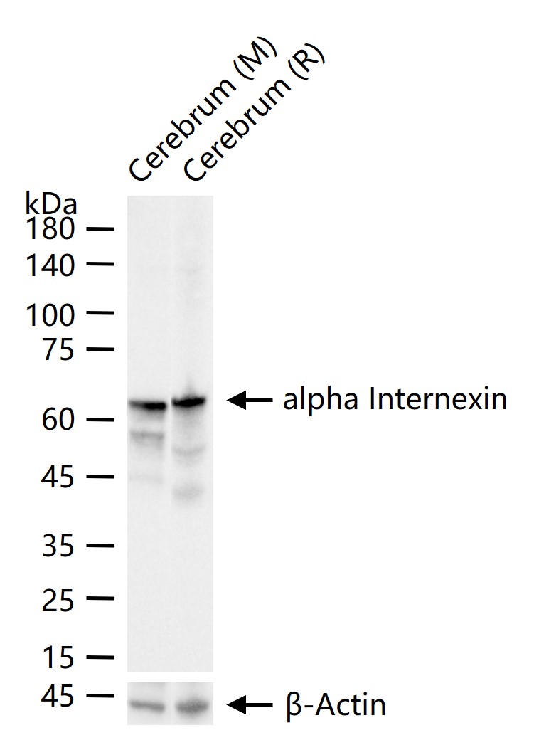 α-中连蛋白重组兔单抗