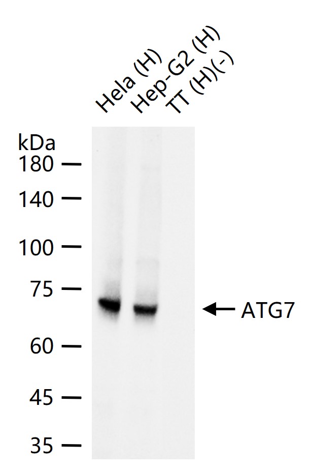 自噬相关蛋白7重组兔单抗
