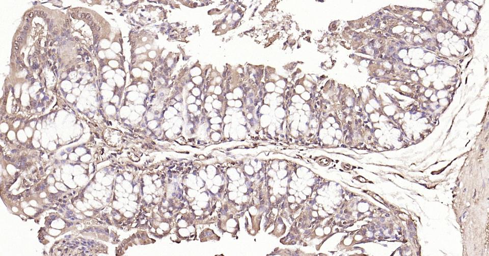 PTEN Mouse mAb (一抗) - IHC-P,IHC-F,IF,ICC/IF | Bioss