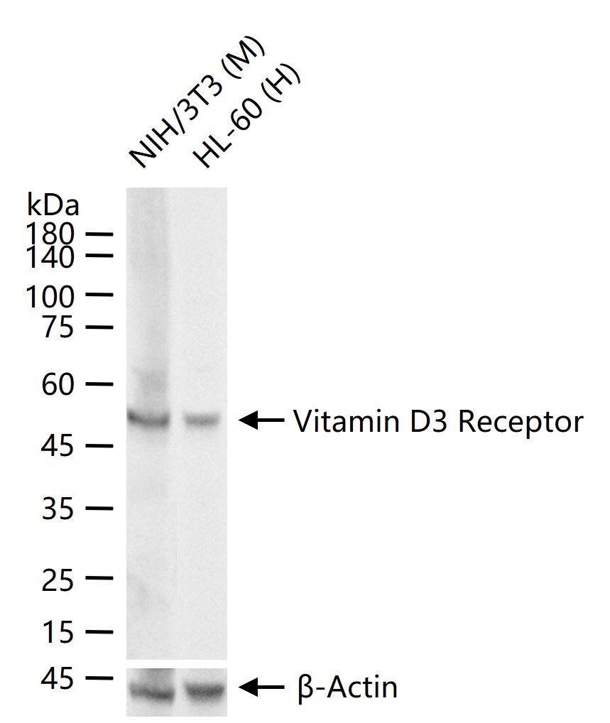 维生素D3受体重组兔单抗