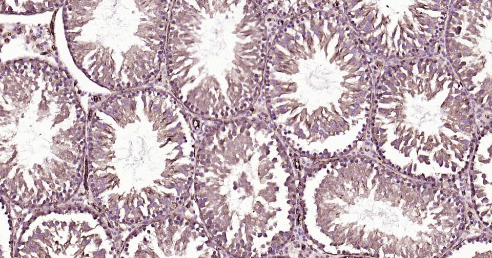 葡萄糖转运蛋白1重组兔单抗