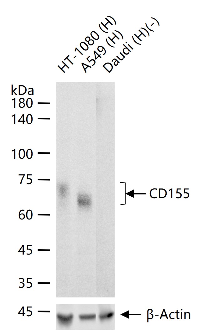 脊髓灰质炎病毒受体重组兔单抗