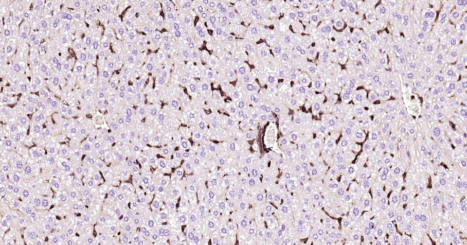 葡萄糖转运蛋白1重组兔单抗