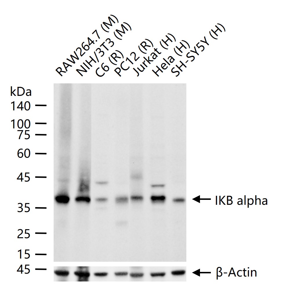核因子κB抑制蛋白α重组兔单抗