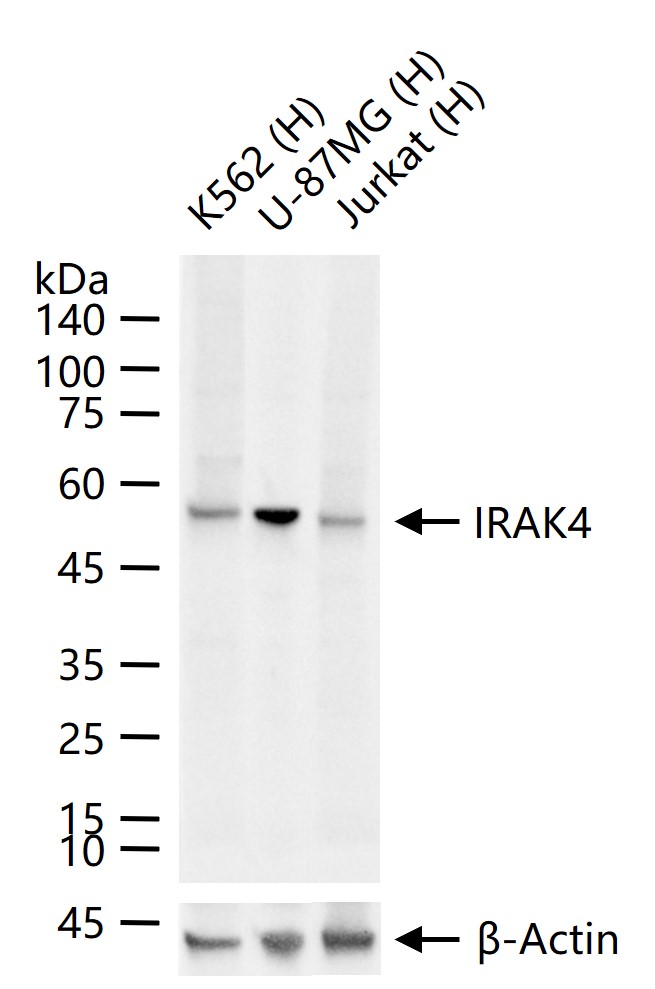 白介素-1受体相关激酶4重组兔单抗