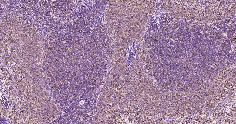 葡萄糖转运蛋白1重组兔单抗