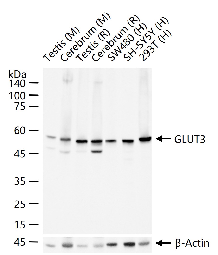 葡萄糖转运蛋白3重组兔单抗