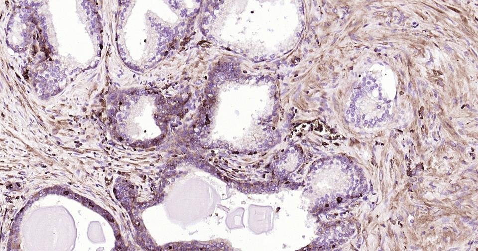 葡萄糖转运蛋白1重组兔单抗