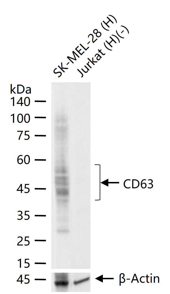黑色素瘤相关抗原重组兔单抗