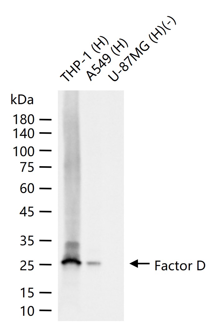 Factor D Recombinant Rabbit mAb (一抗) | Bioss