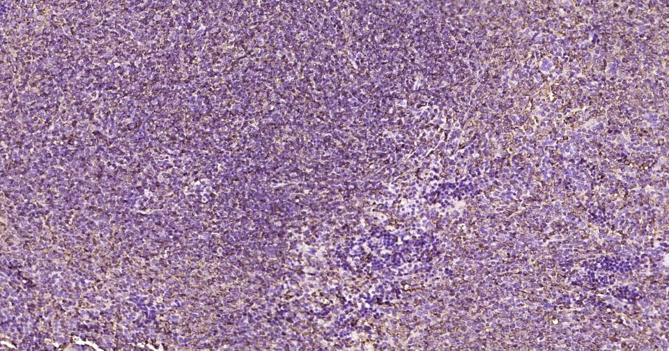 葡萄糖转运蛋白1重组兔单抗