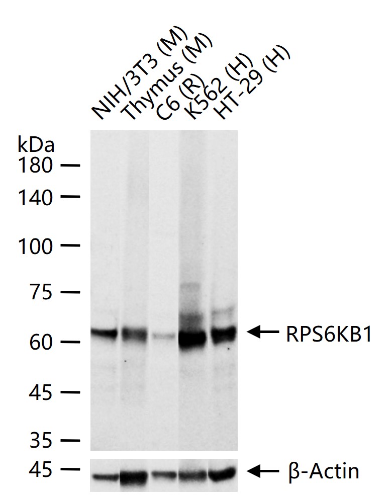 核糖体S6蛋白激酶重组兔单抗
