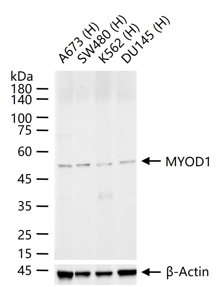 肌原调节蛋白重组兔单抗