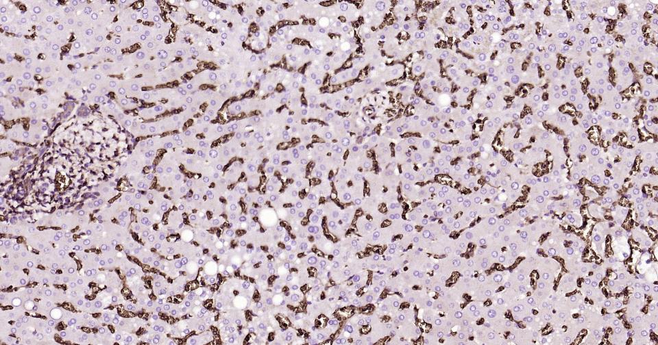 葡萄糖转运蛋白1重组兔单抗