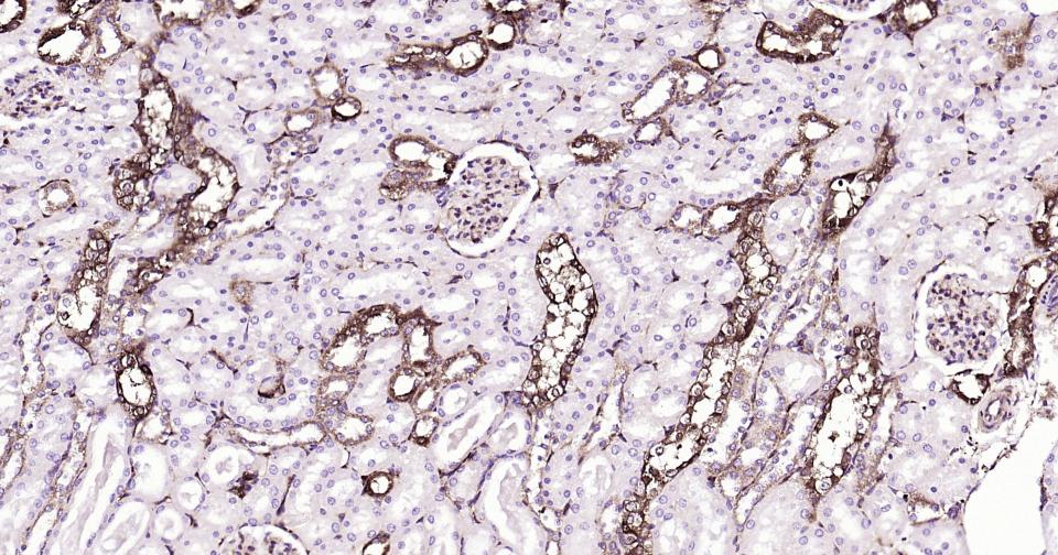 核因子κB抑制蛋白α重组兔单抗