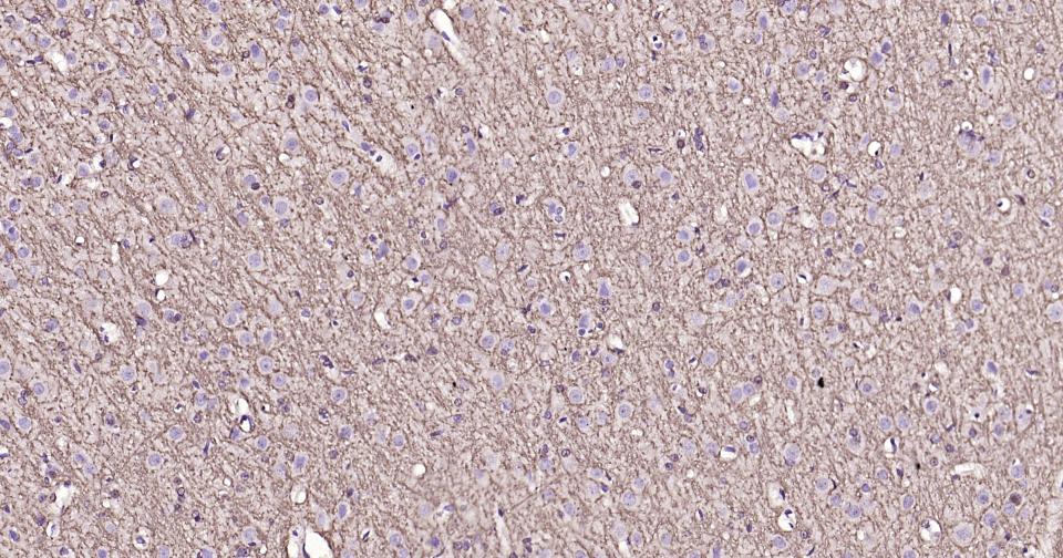 髓鞘碱性蛋白/磷脂碱性蛋白重组兔单抗