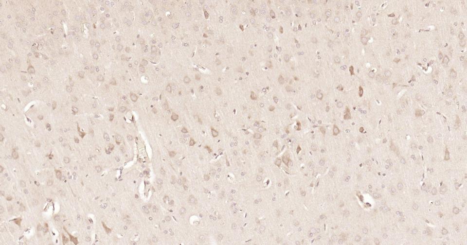 信号转导和转录激活因子3重组兔单抗
