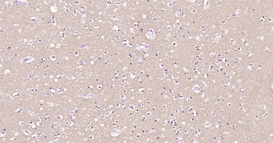 微管蛋白β1 tubulin(内参)单克隆抗体-bsm-33041M