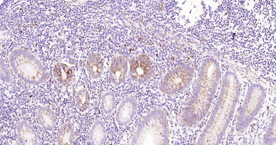 谷氨酰胺酶重组兔单抗