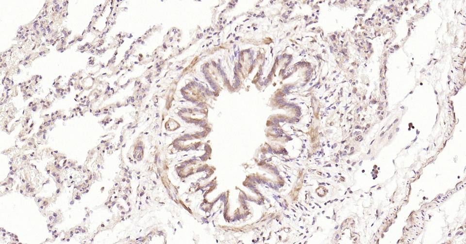 信号转导和转录激活因子3重组兔单抗