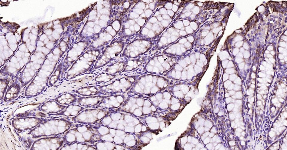 核因子κB抑制蛋白α重组兔单抗