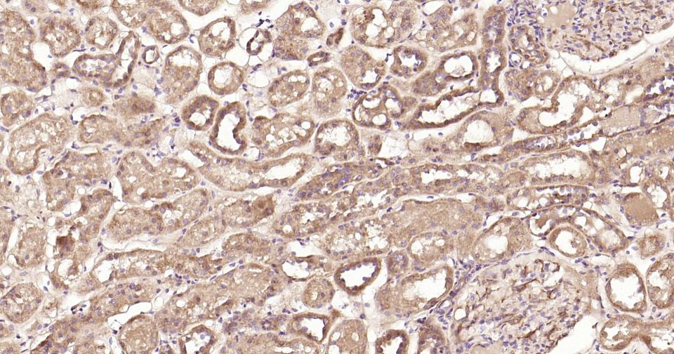 信号转导和转录激活因子3重组兔单抗
