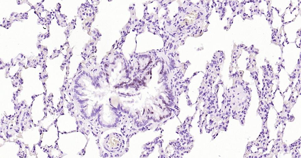 磷酸化信号转导和转录激活因子3重组兔单抗