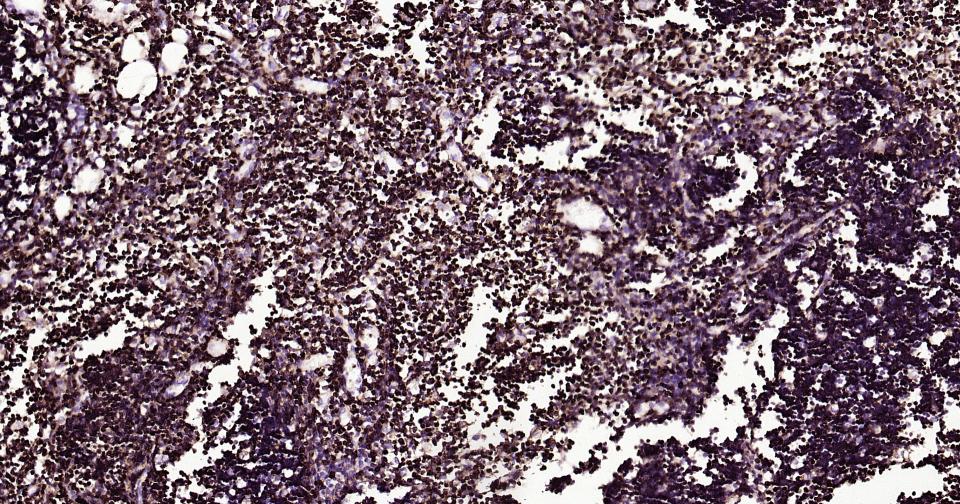 白细胞共同抗原CD45重组兔单抗