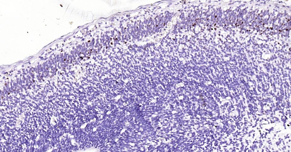 TBR1蛋白重组兔单抗