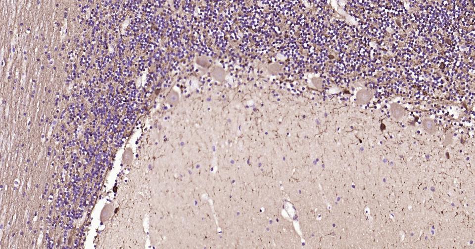 钙结合蛋白重组兔单抗