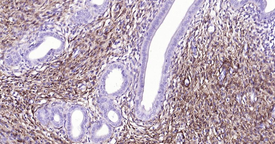 神经生长因子受体重组兔单抗-bsm-52253R